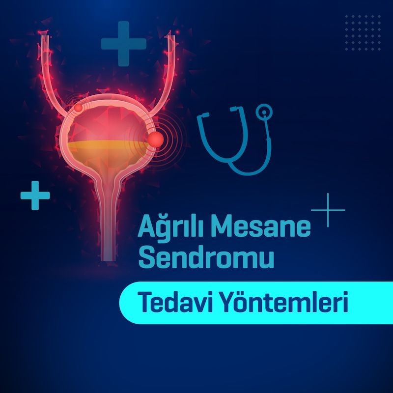 agrili mesane sendromu tedavisi