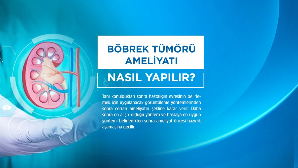 Böbrek tümörü tedavi seçenekleri