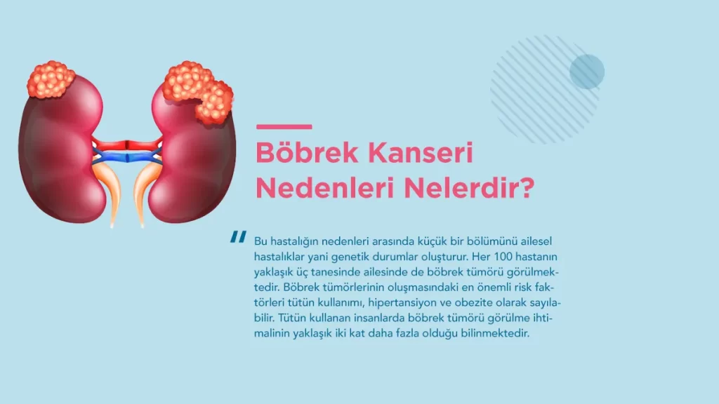bobrek kanseri neden olur