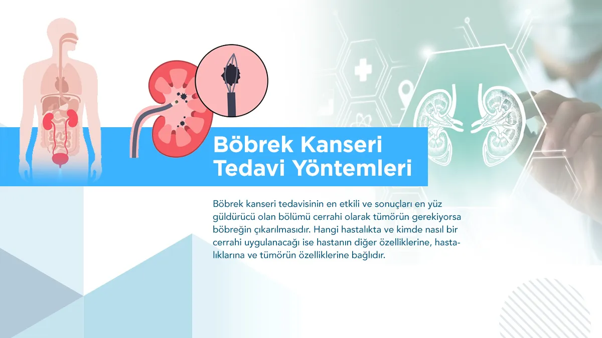 bobrek kanseri tedavisi