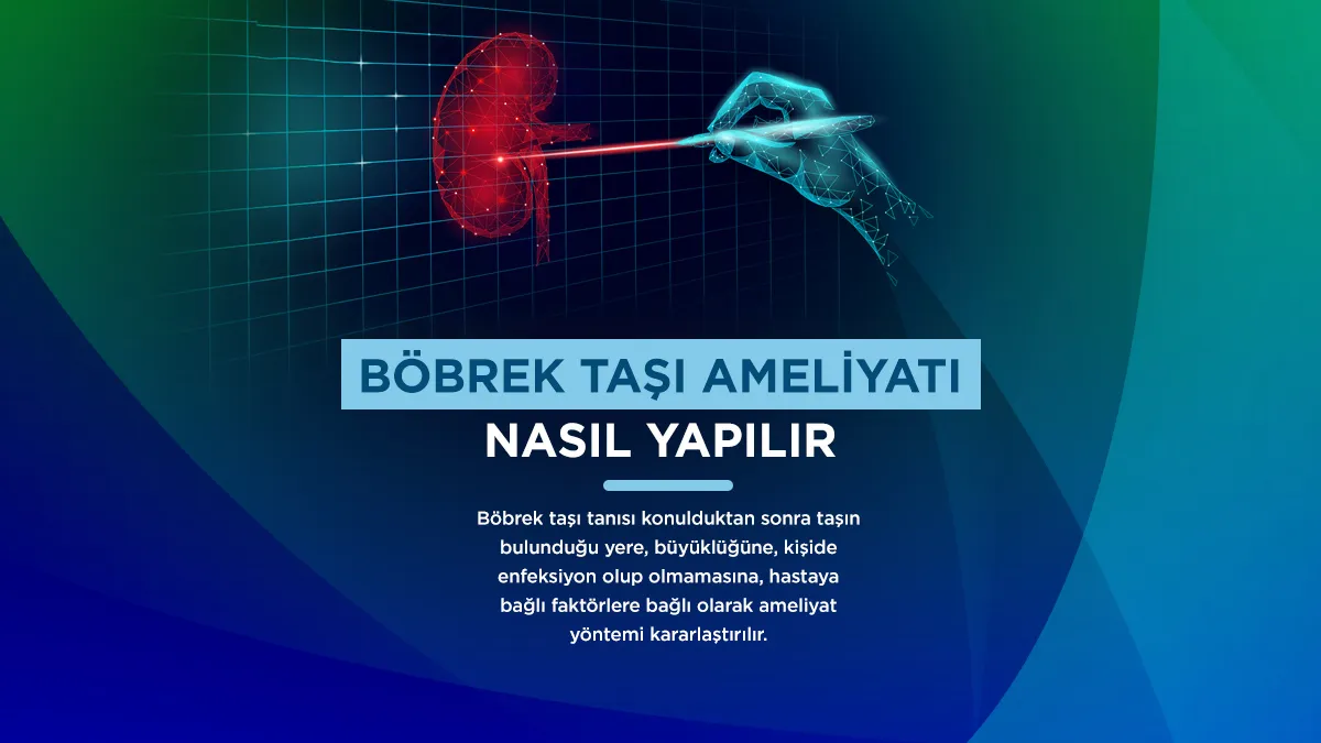 Böbrek taşı ameliyatının avantajları nelerdir