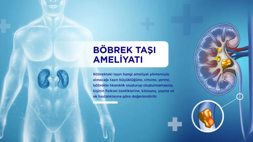 bobrek tasi ameliyati