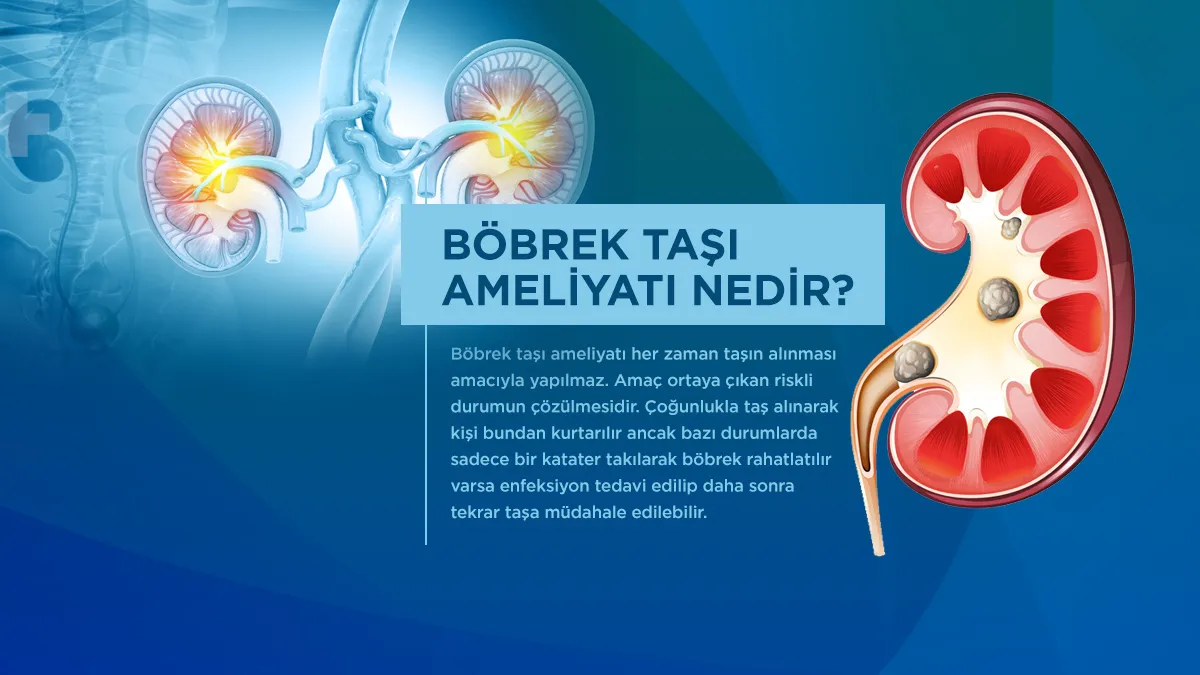 Böbrek taş ameliyatı hangi durumlarda yapılır