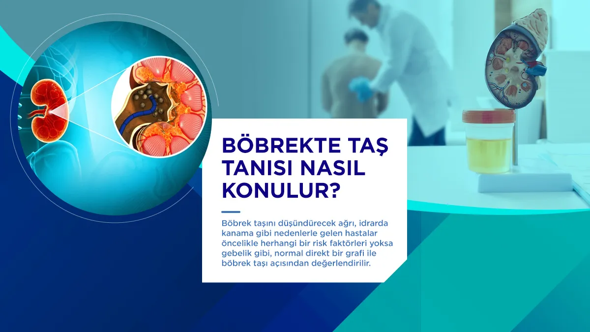 bobrekte tas tanisi
