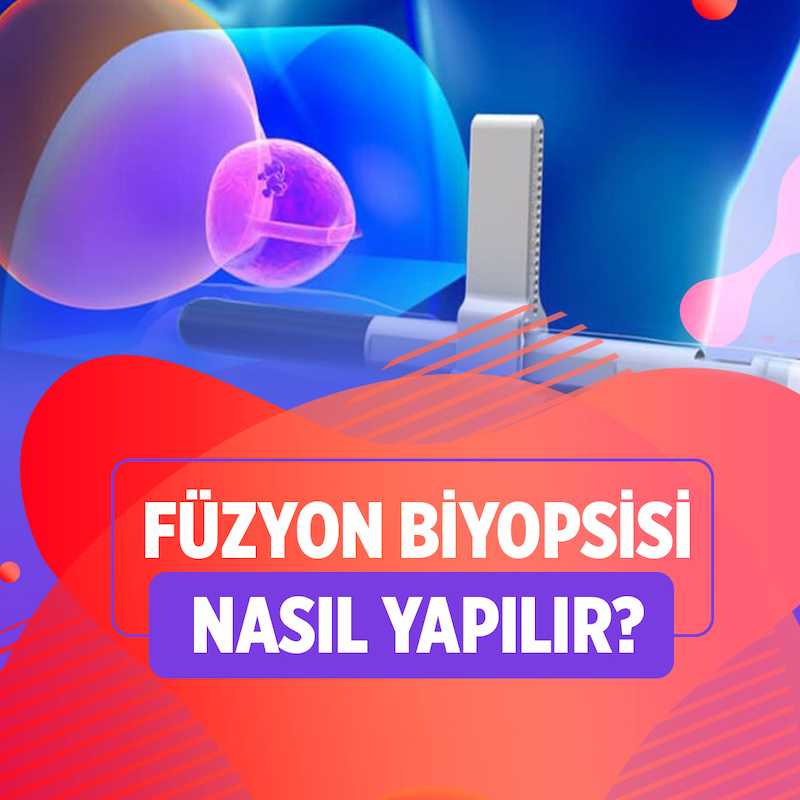 Mr-trus füzyon biyopsi