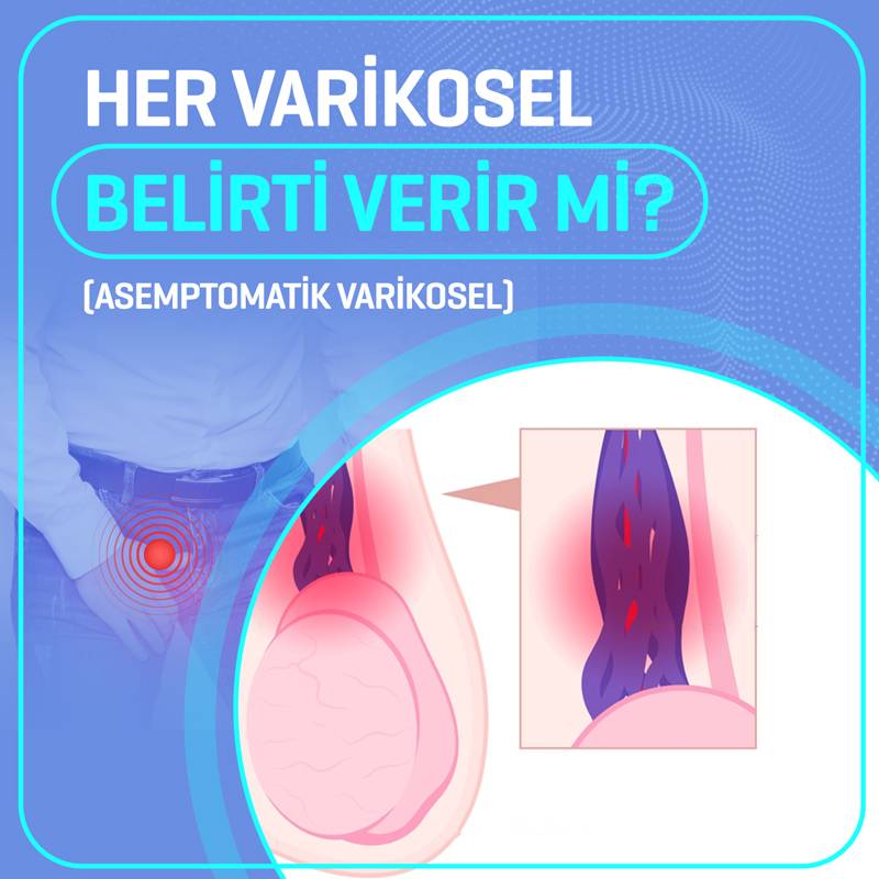 her varikosel belirti verir mi