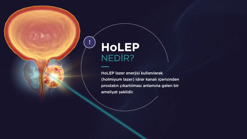 HoLEP Ameliyatı Nasıl Yapılır?